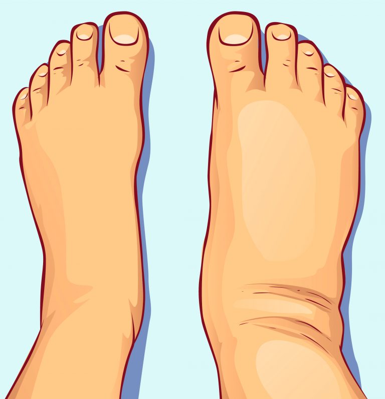 ≡ 17 Warning Signs Of Prostate Cancer 》 Life 360 Tips